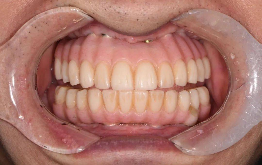 定期复查洋紫荆,是国内知名的牙科技工中心,成立于1998年.