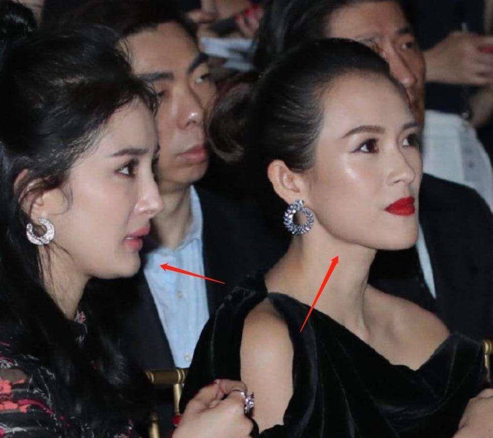 除了脸上挂不住肉,杨幂瘪嘴,下巴后缩也很厉害.