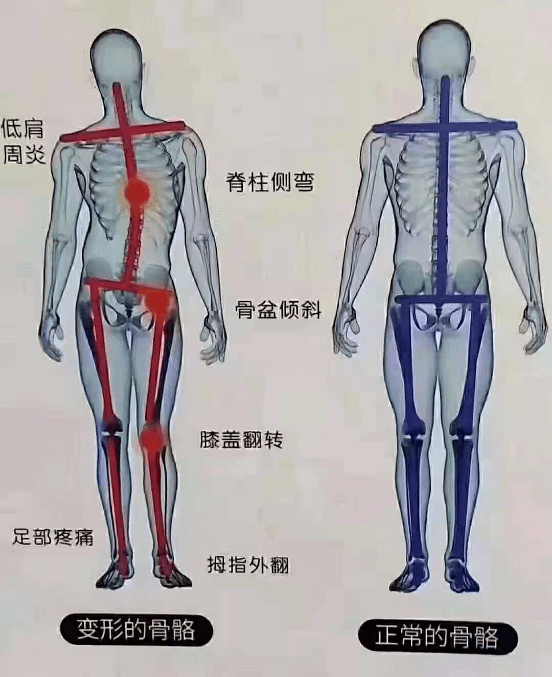 而龙氏骨相美体,即是从内正骨骼,到外提皮相,达到内调外养,骨龄与体态