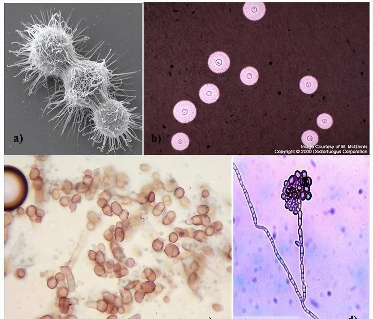 新型隐球菌在显微镜下菌体呈圆形,直径4~8微米,菌落边缘为黑色