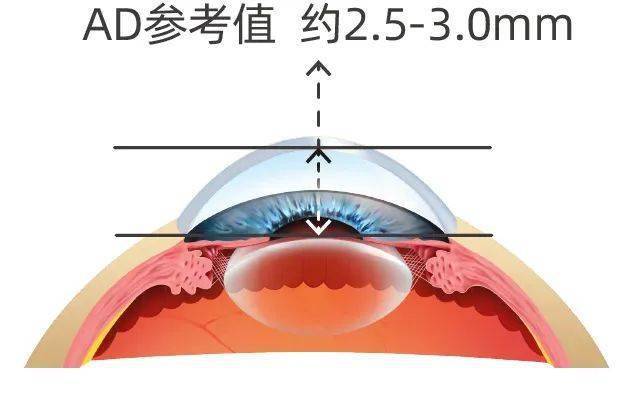 光学生物测量报告解读 | 再也不用担心看不懂孩子的眼科检查报告单了_角膜_散光_屈光