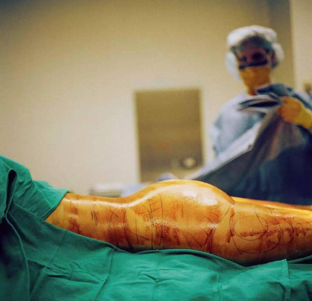 给中国人的100条健康小建议_危害_辐射_热水