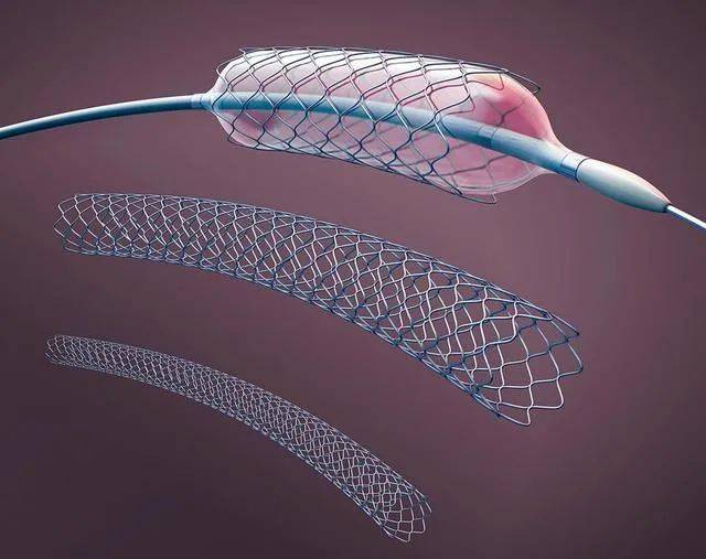 冠脈支架集採,不只是降價_產品_採購_國家組織