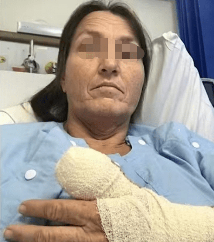 可怕| 澳女面临截肢!只因做了个指甲?妹子一定注意!当心后悔终身!
