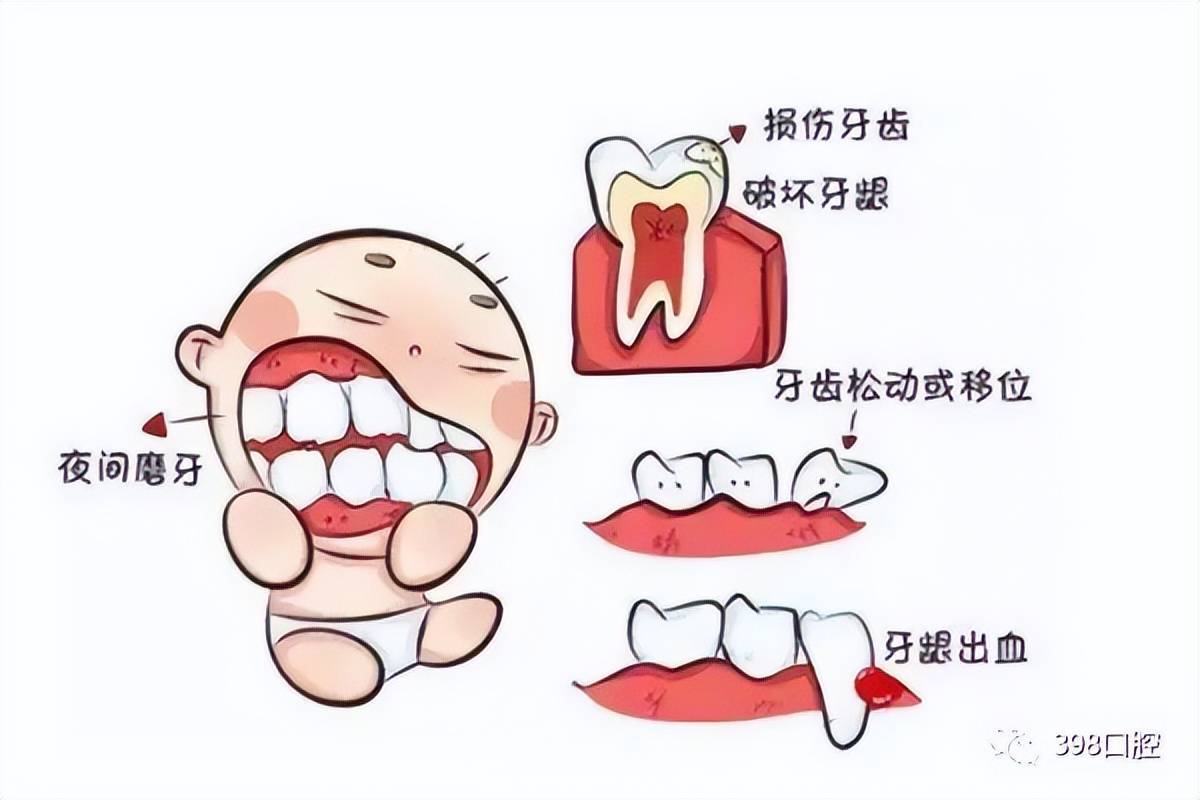牙友:儿童磨牙症怎么治疗?儿童夜间磨牙试试这几招_孩子_牙齿_家长