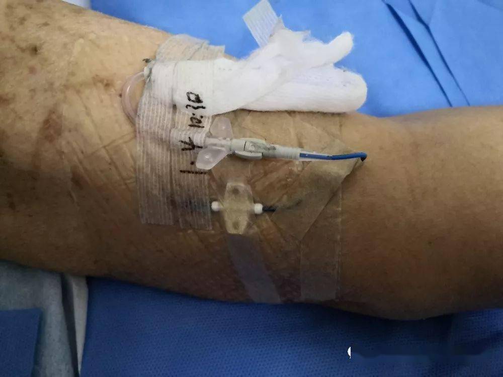 picc导管固定,大家一起来找茬_贴膜_问题_患者