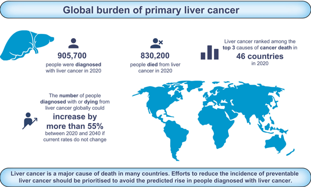 全球原发性肝癌负担及2040年预测报告