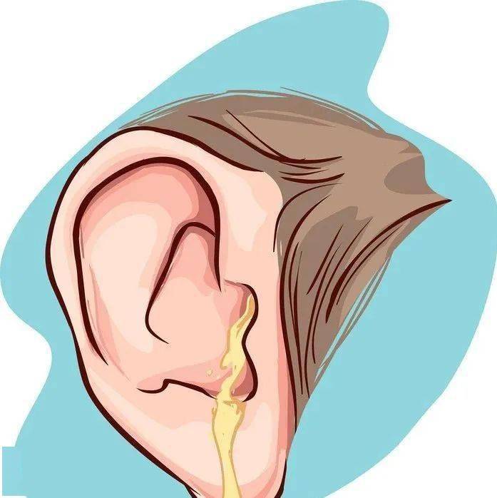 从穿孔处可见鼓室内有灰白色鳞屑状或豆渣样物质,奇臭!