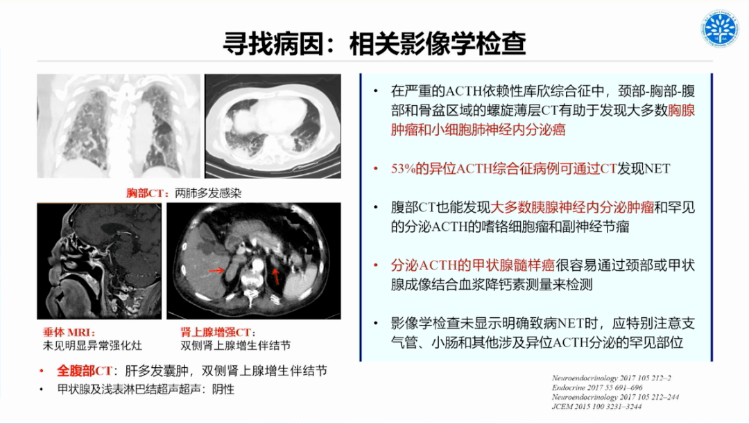 病例分享 | 库欣综合征危象的诊治_mmol_治疗_患者