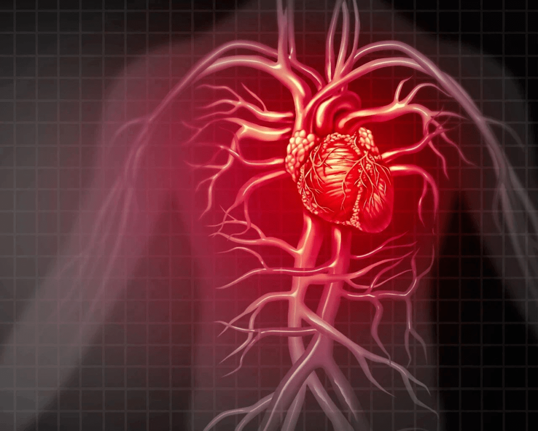 冬季心梗高發!12個意想不到的預兆!