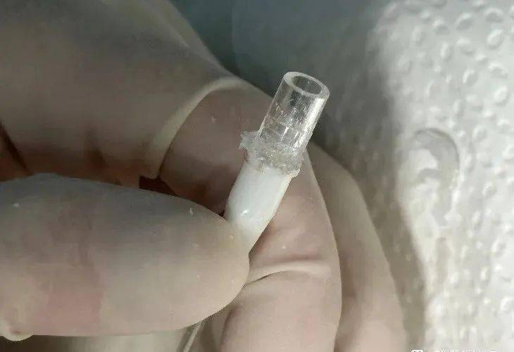 肝素帽和picc旋得过紧,拧不开,怎么办?_导管_接头_护理