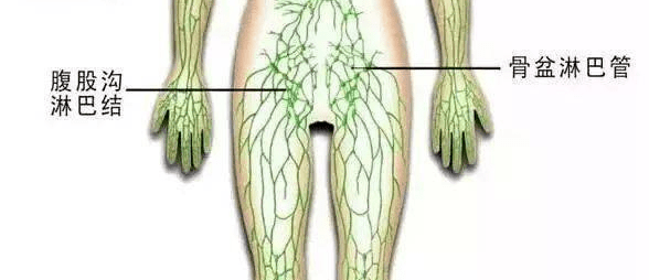 腹股沟淋巴结解剖图图片
