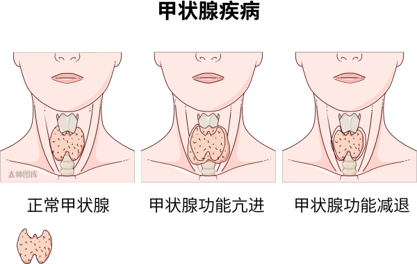 tsh 是测试甲状腺功能的非常敏感的特异性指标,游离甲状腺浓度的微小