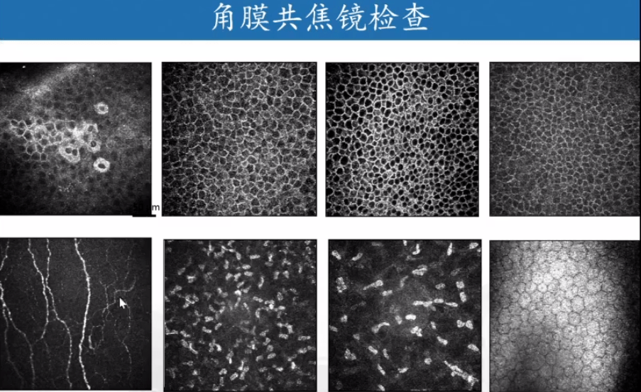 角膜高倍镜图片