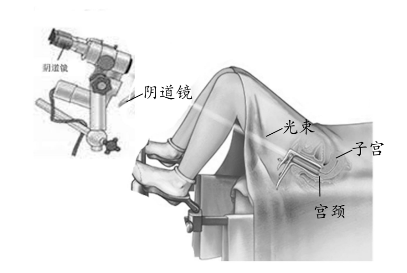 阴超镜检查疼吗图片