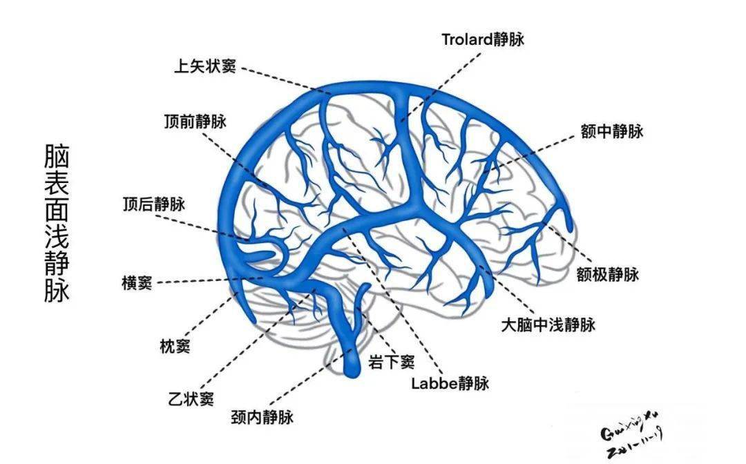 大脑桥静脉示意图图片