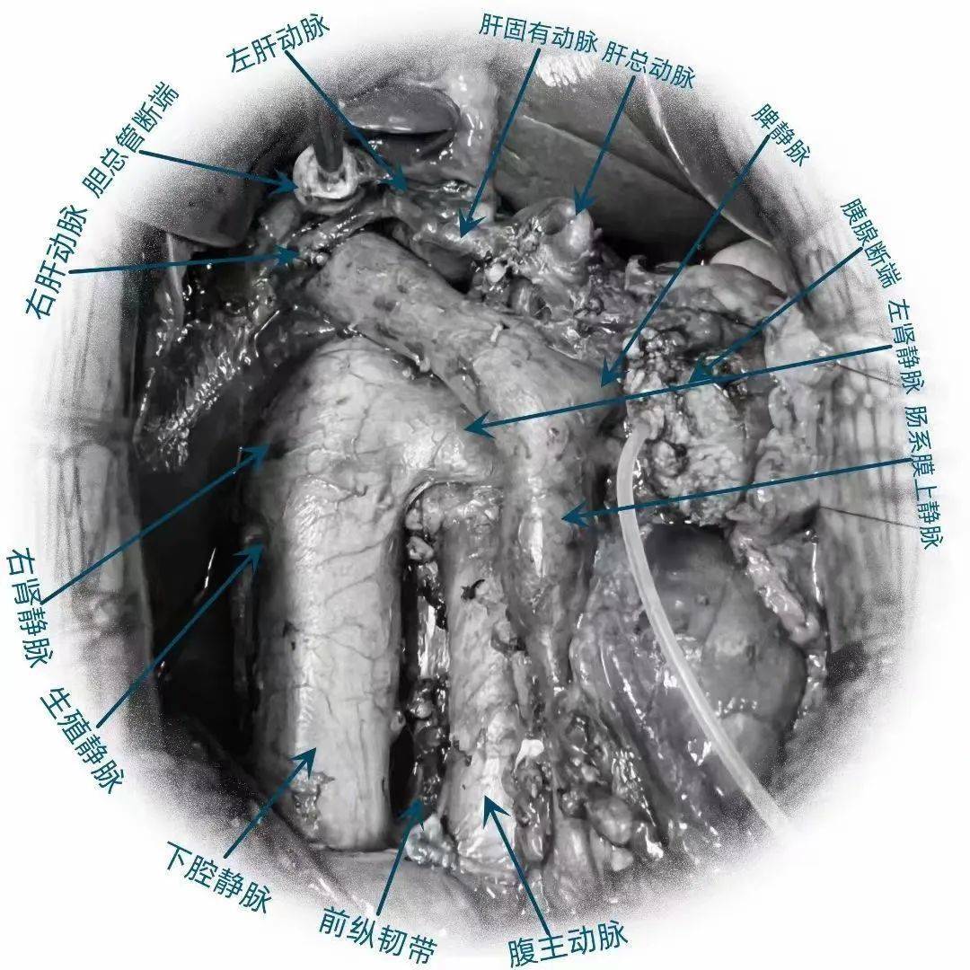 创伤救治丨保山市二院"生死时速"抢救一名严重创伤患者