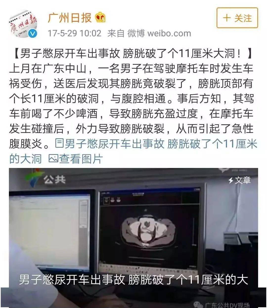 有人膀胱突然爆炸?什么?