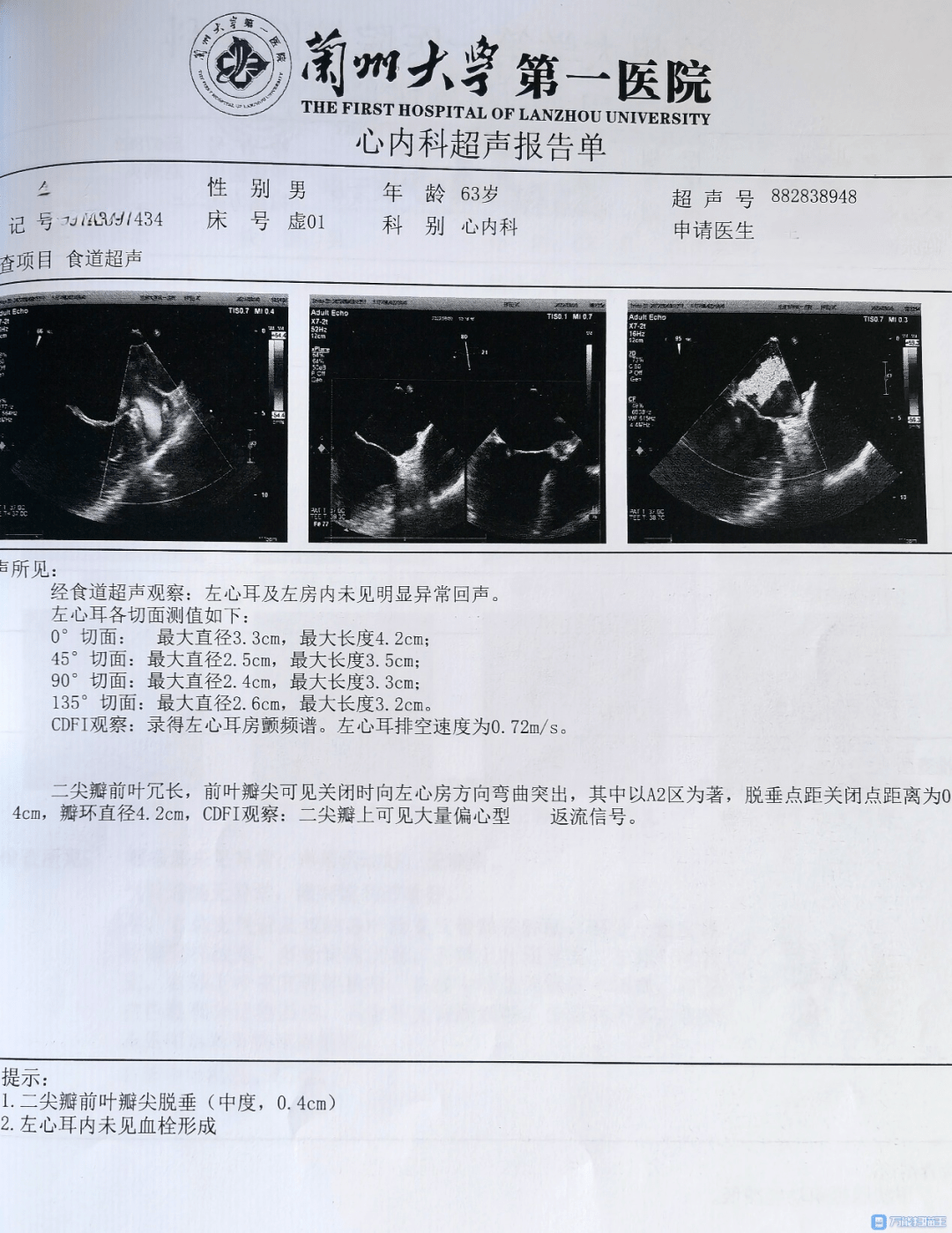 会宁县医院手术室传来好消息_综合征_心电图_患者