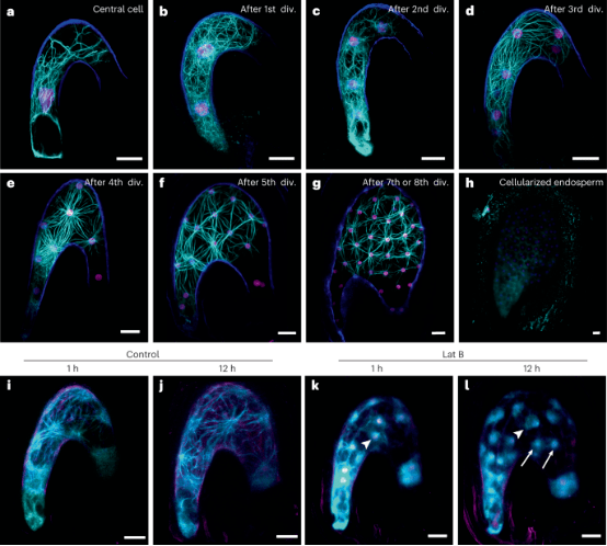Nature Plants | 结合细胞成像技术和遗传学手段解析拟南芥胚乳发育过程_合胞_植物
