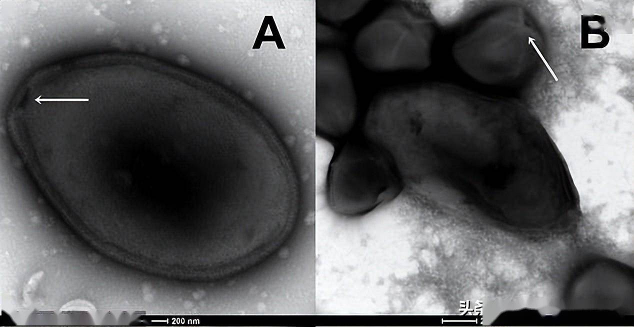 气候变暖或唤醒僵尸病毒,欧美专家发出警告!分析:重点是冻土