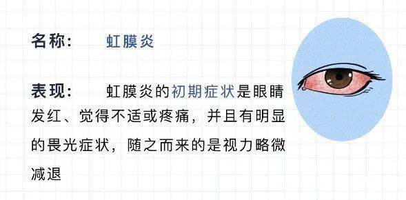 什么是红眼病 来自搜狐网