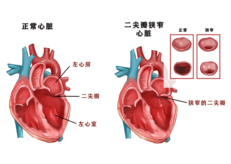 心脏瓣膜图示图片