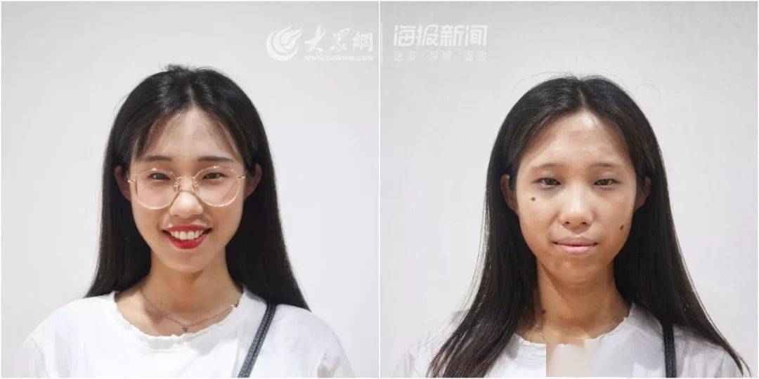 社交网站"毒虫仿妆"被追捧,然而现实吸毒者:牙齿脱落,五官坍塌,毒疮