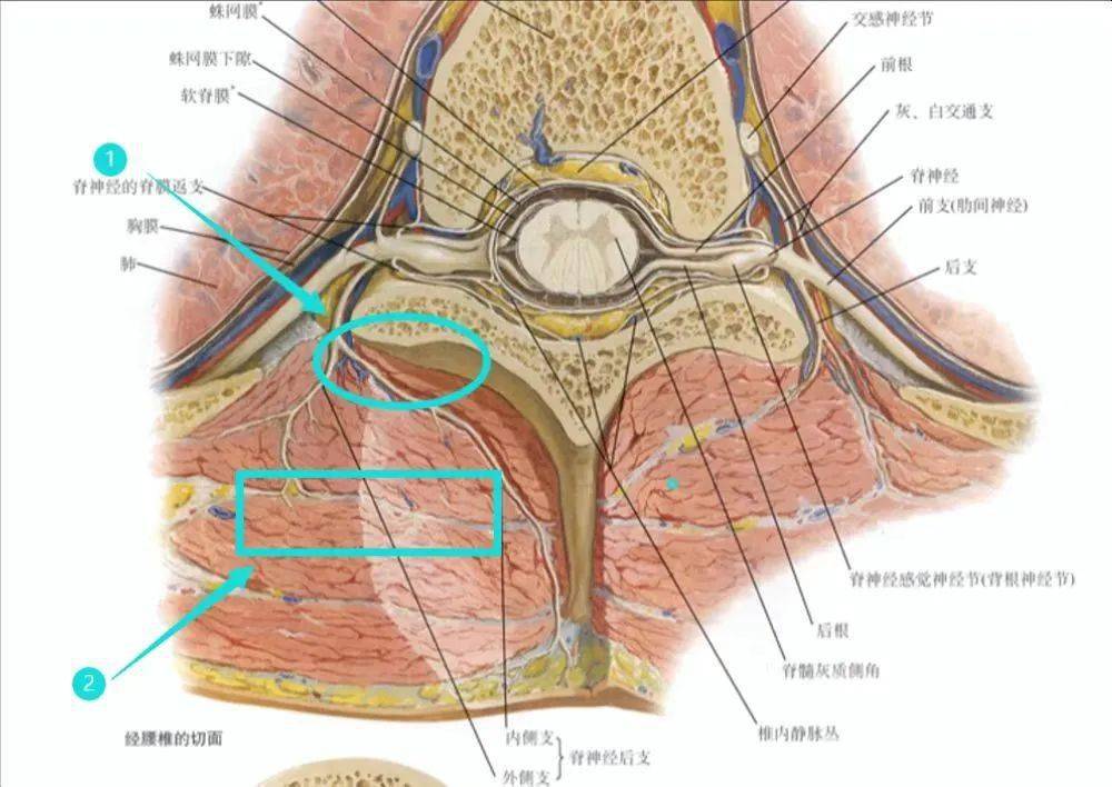 當注射於菱形肌與豎脊肌間隙(入路②),解剖可見豎脊肌腹側面,脊
