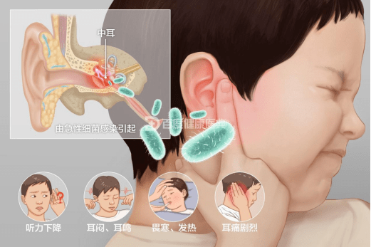 儿童中耳炎怎么治疗图片