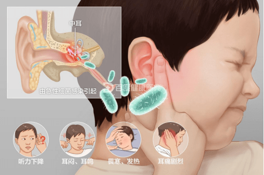 宝宝总是挠耳朵,还哭闹不止,当心急性中耳炎!_儿童_检查_疾病