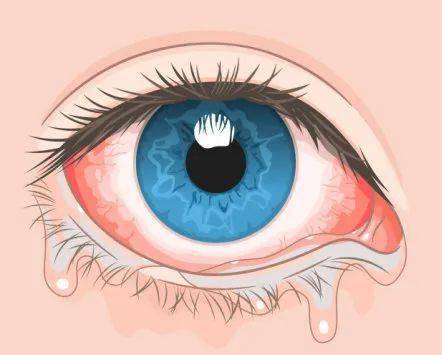 这个季节,眼科门诊常常能见到这样的小患者,他们眼睛红红的,又时常忍