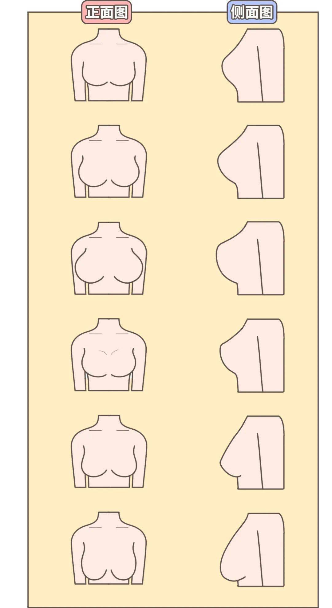 什么样的乳腺增生更容易癌变?一文揭开女生胸部的小秘密