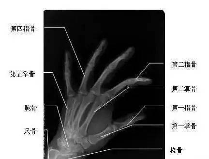 手腕高骨处在哪个位置图片