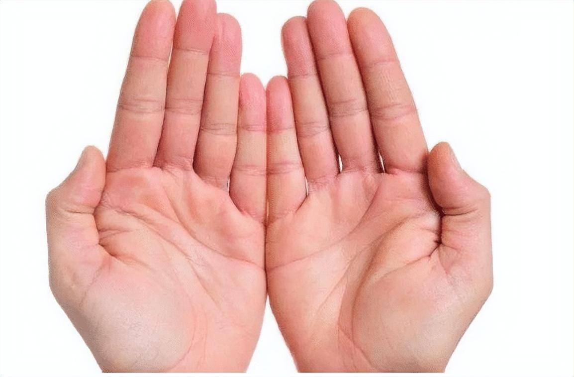 健康人手掌的颜色是淡红色或粉红色,红润而富有光泽,弹性,用手挤压后