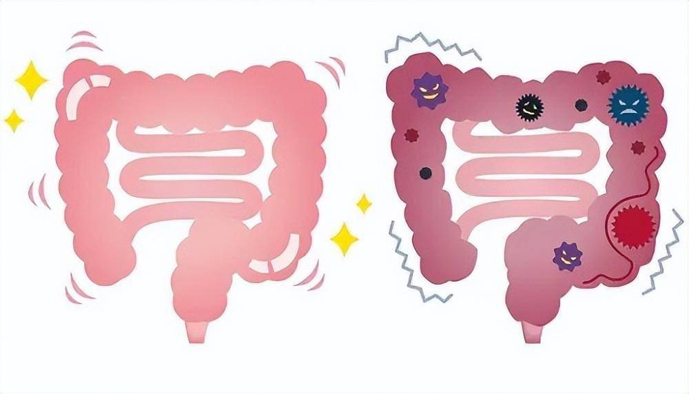 肠道菌群紊乱,也会影响生殖免疫内分泌及生育能力!