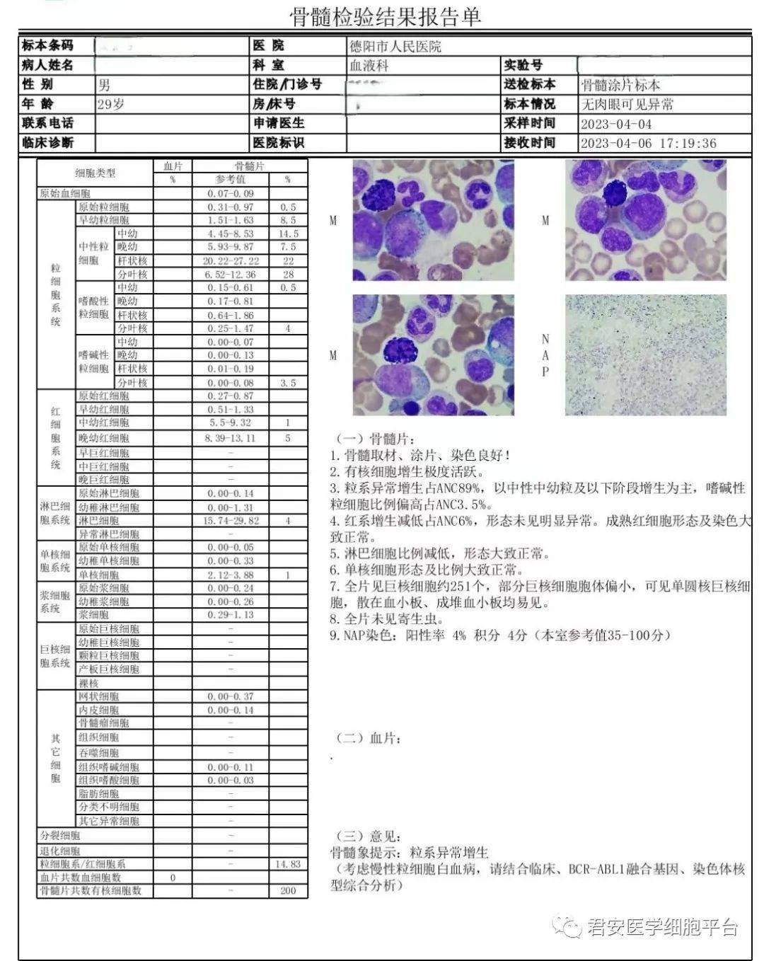 骨髓涂片细胞学图文报告骨髓细胞涂片外周血细胞涂片血常规生化b 超