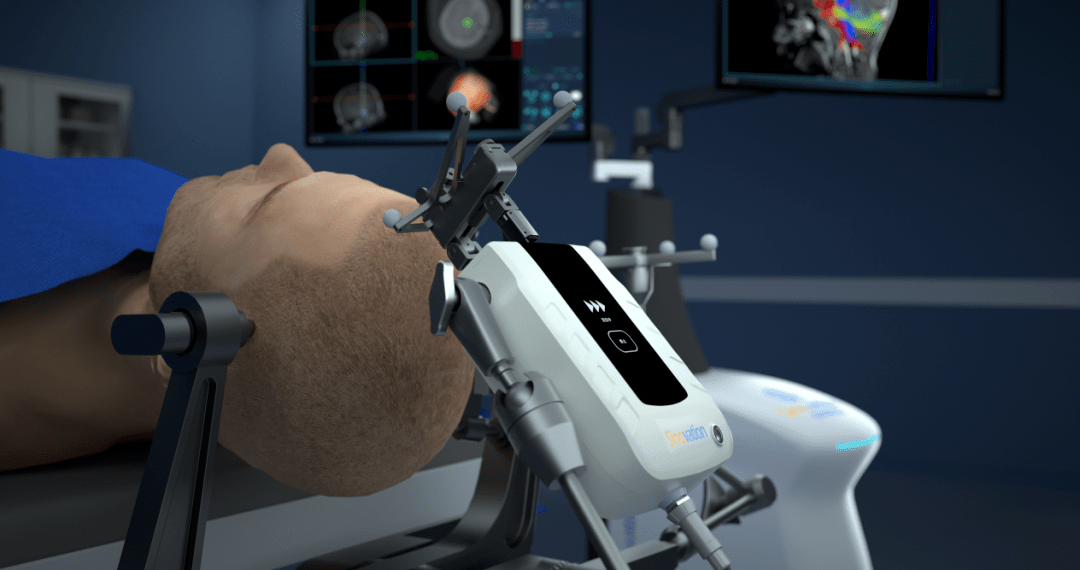 天坛医院刘焕光医师-q300微型穿刺机器人辅助活检及ommaya囊置入_手术