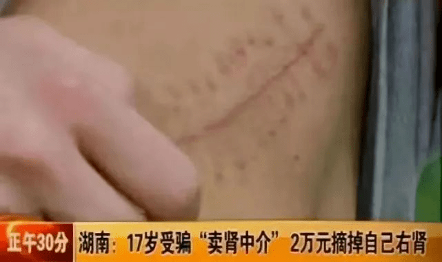 四川90后夫妻自导自演色情片被抓，绝不是多管闲事！