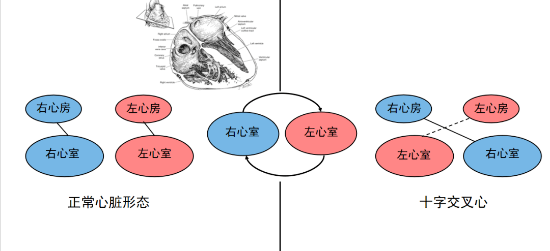 十字平面交叉图解图片