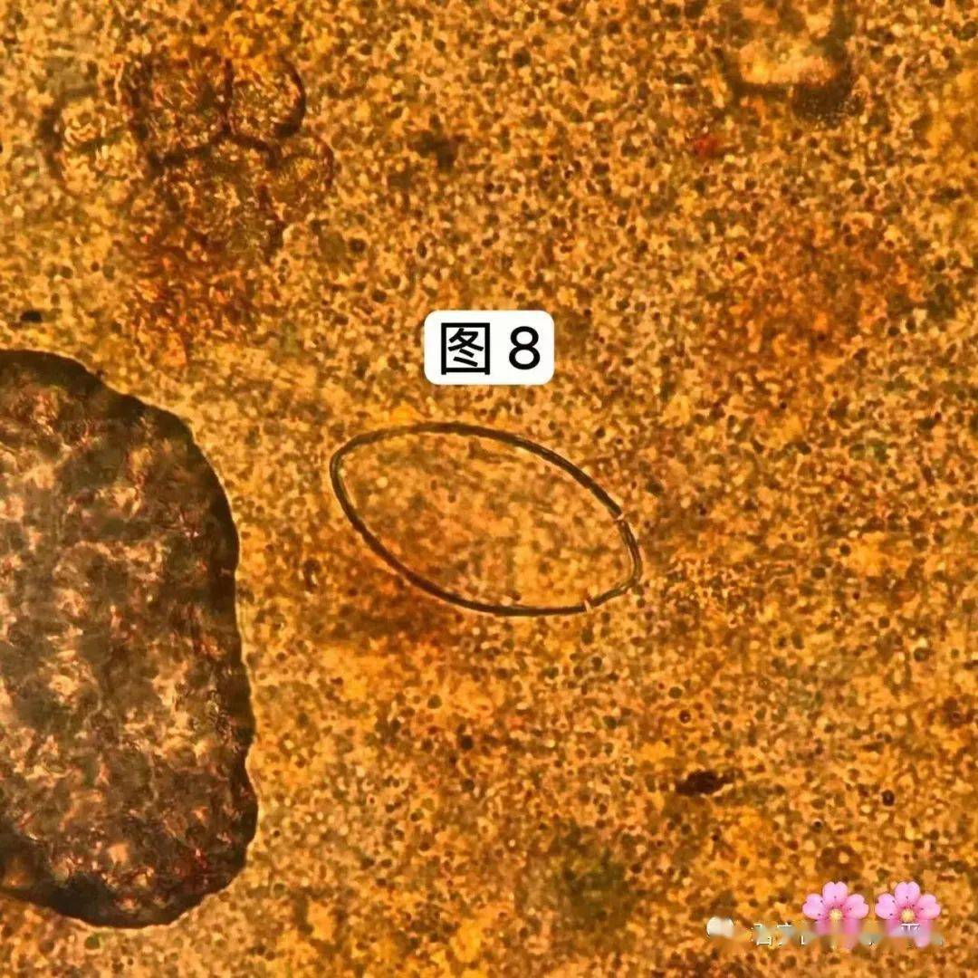 絛蟲卵點擊空白處查看答案04肺吸蟲卵點擊空白處查看答案03日本血吸蟲