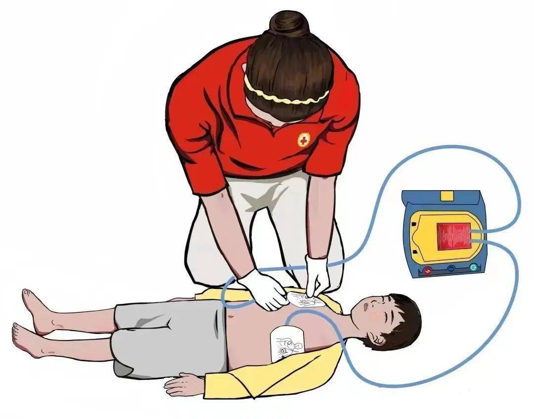 "救"在身边,你我同行丨区卫健局开展急救知识及aed操作培训(附青白江