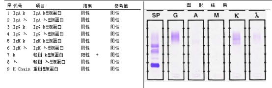 球蛋白和血免疫固定电泳检查先安排林先生进行了在看了林先生的病历后