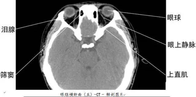 套路男友ct照片图片