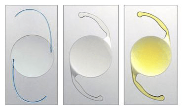 【小南话科普】白内障手术时如何选择适合的人工晶体?