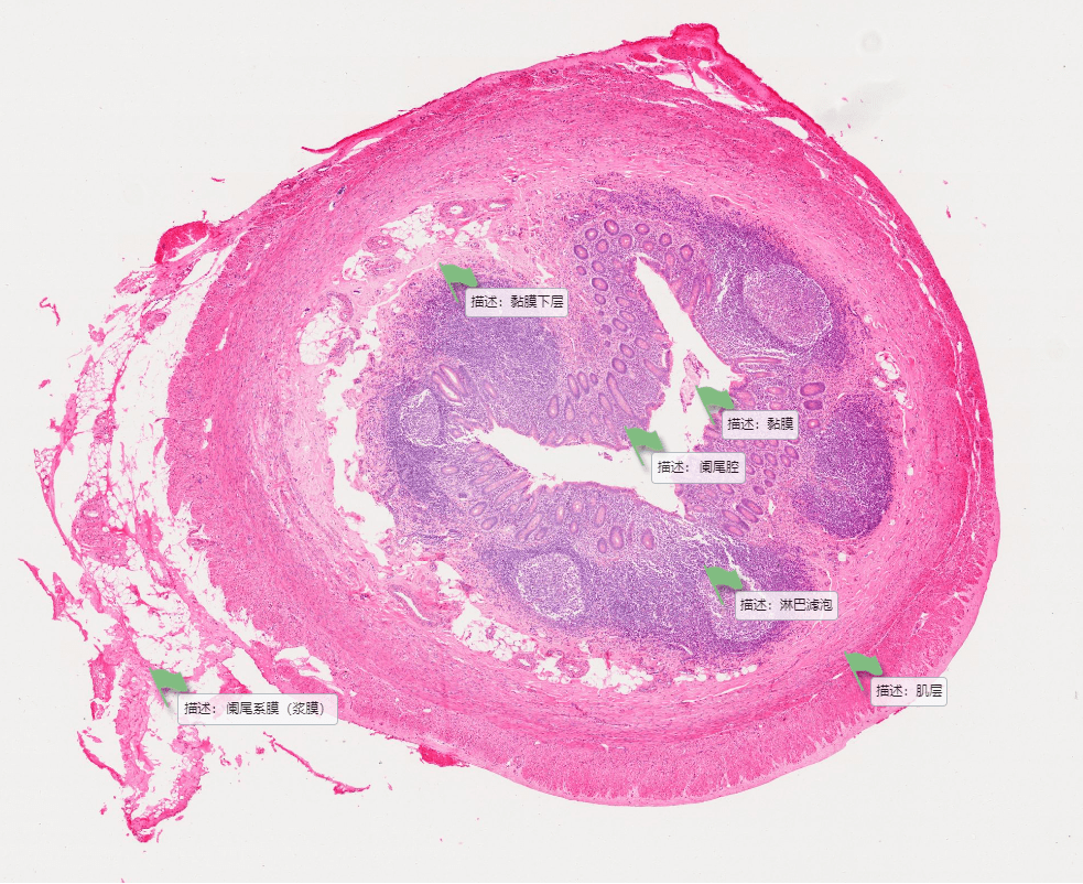 阑尾肌层图片
