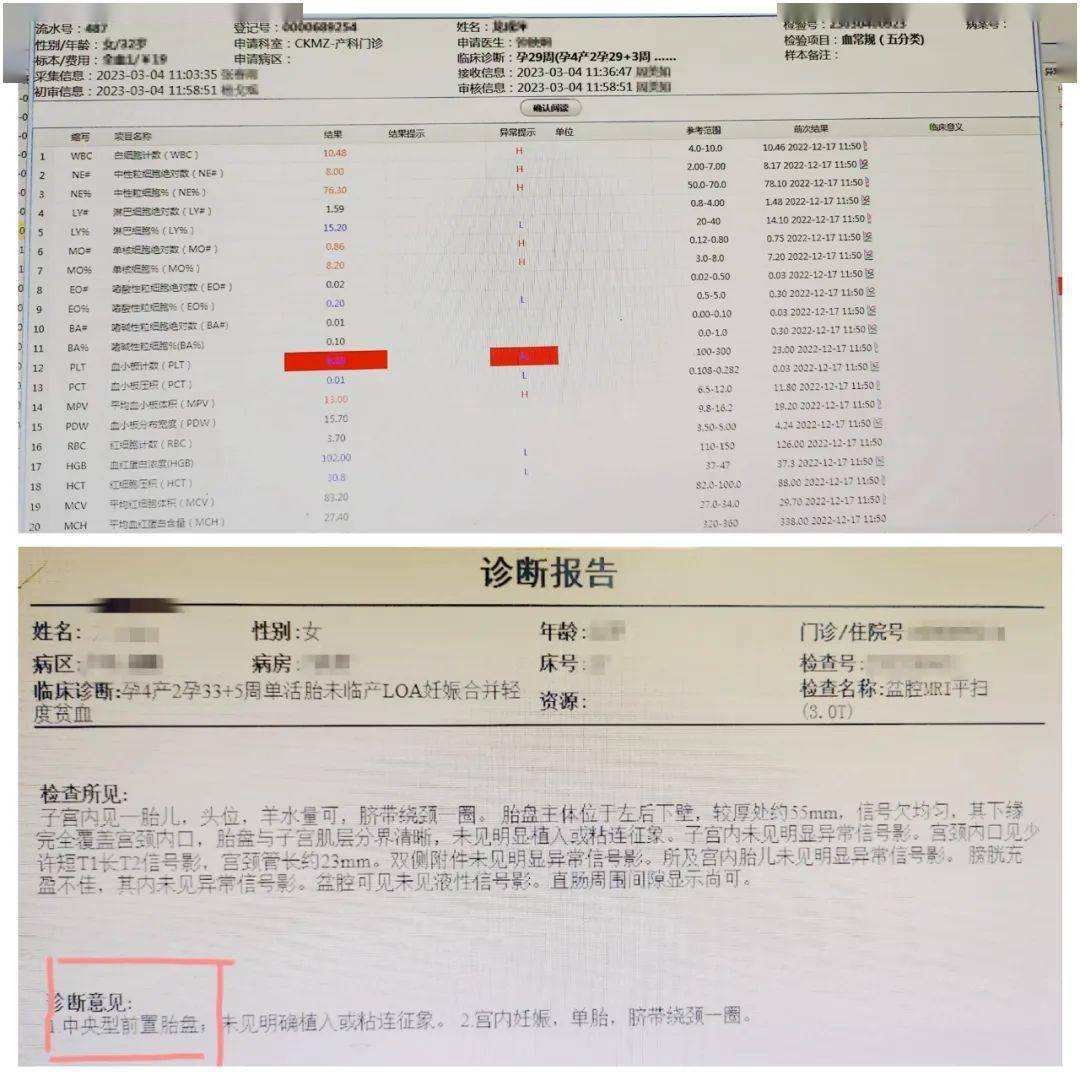 市人民醫院成功救治1例原發性血小板減少症合併中央性前置胎盤產婦