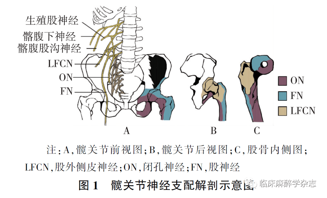 综述| 区域阻滞麻醉技术在髋关节手术中的应用进展_神经_患者_nerve