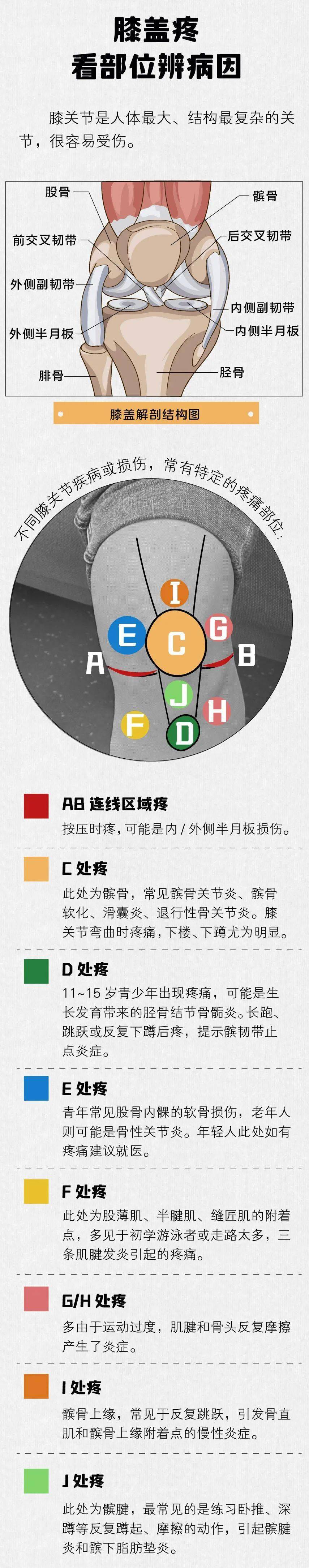 「膝盖疼痛位置」对照表