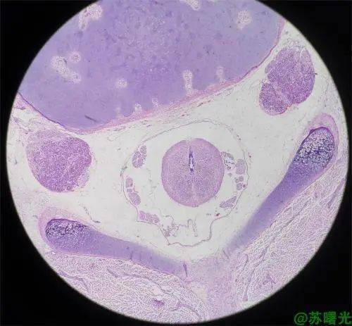 编号:2530作品标题:亲子遨游作者:苏曙光作品简介:这是一个子宫内膜